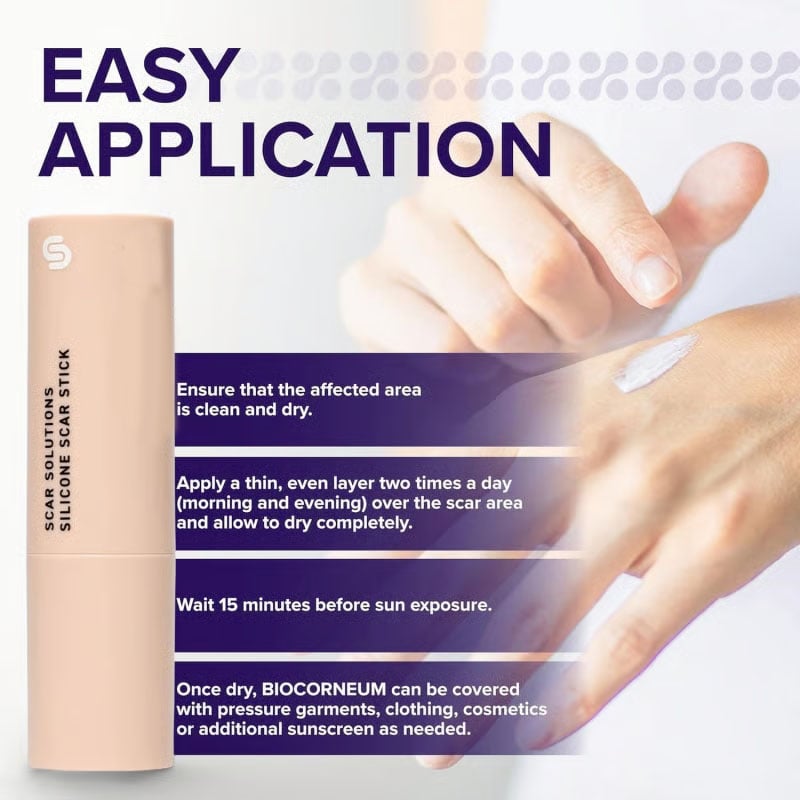 Skin Scar Solutions🛡️ 60%  Silicone Scar Stick.